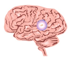 Pineal gland function is important and it's important to get enough sleep to keep it healthy.