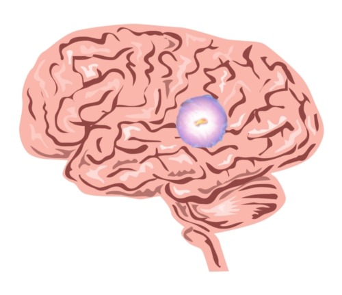 Pineal gland function is important and it's important to get enough sleep to keep it healthy.